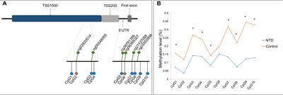 Neural Tube Defects and ZIC4 Hypomethylation in Relation to Polycyclic Aromatic Hydrocarbon Exposure